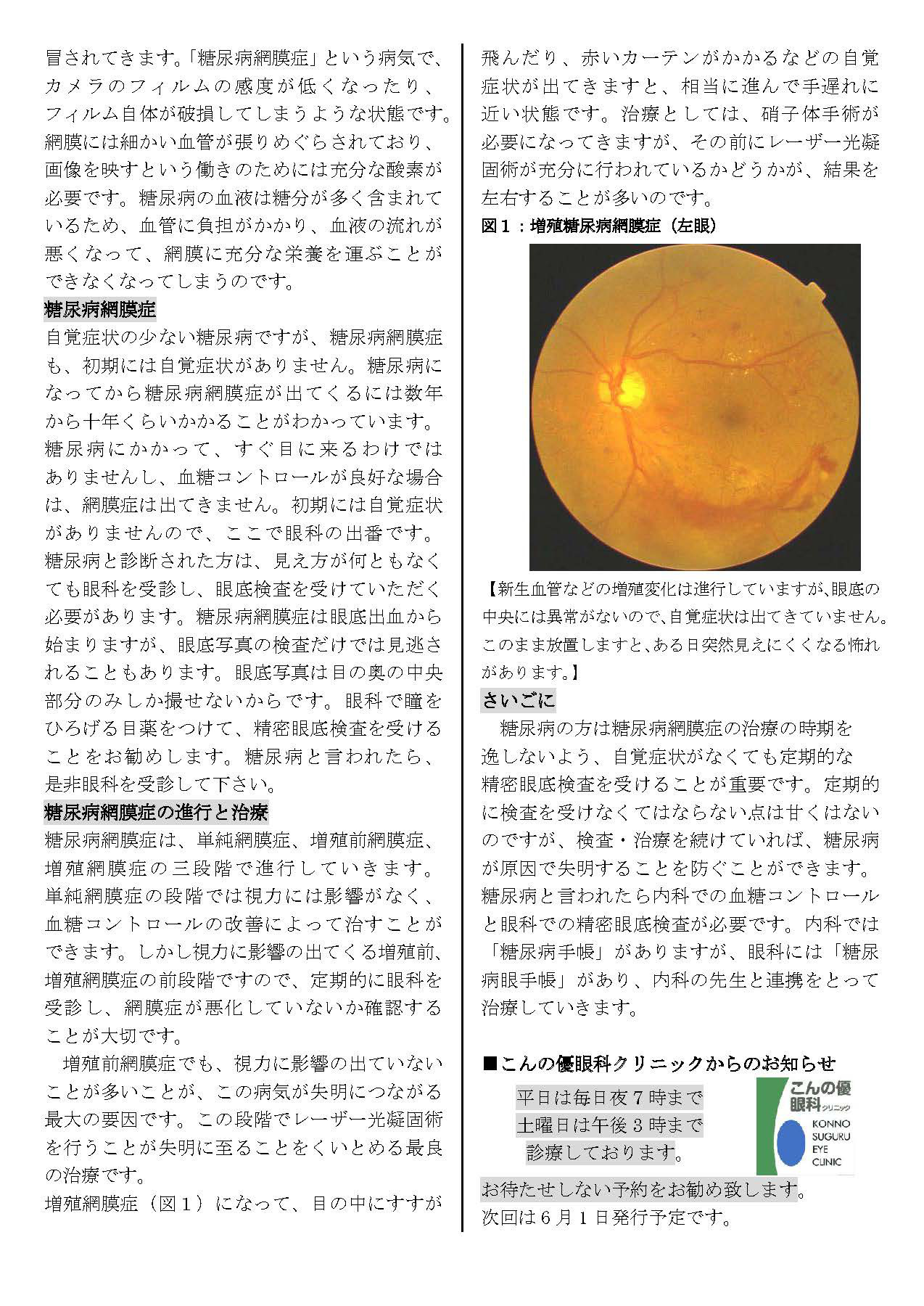 優しい眼科通信18号2