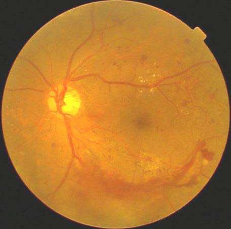 診療案内 こんの優眼科クリニック